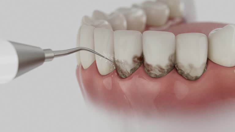 Trusted Dental Implants service in East Lansing, MI - Dentist Open Now